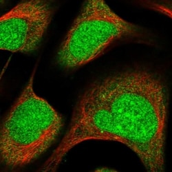 ZNF195 Antibody, Novus Biologicals 0.1mL; Unlabeled:Antibodies, Polyclonal